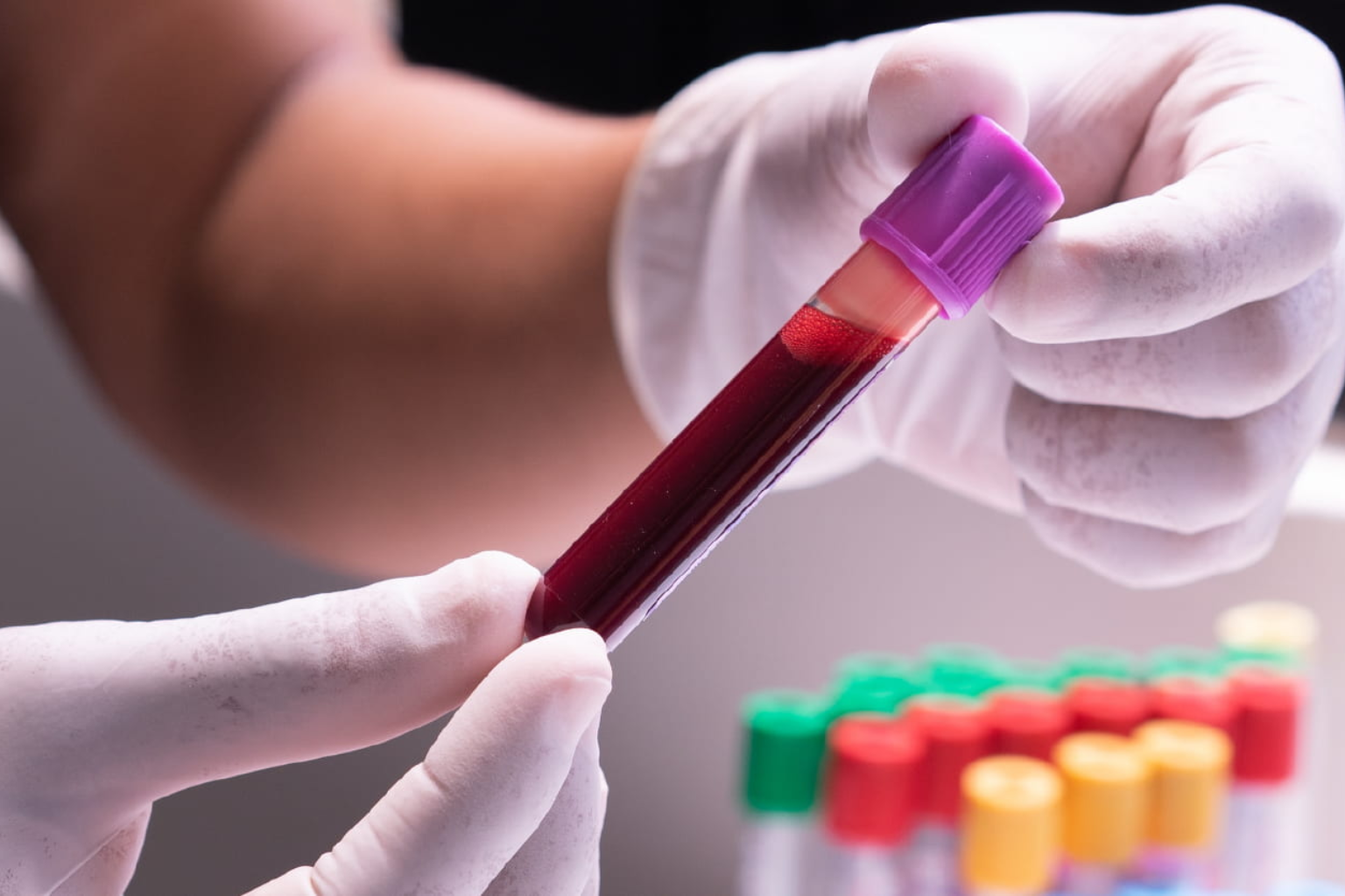 Blood Testing Services